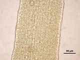 7 – Cellule corticali in visione superficiale